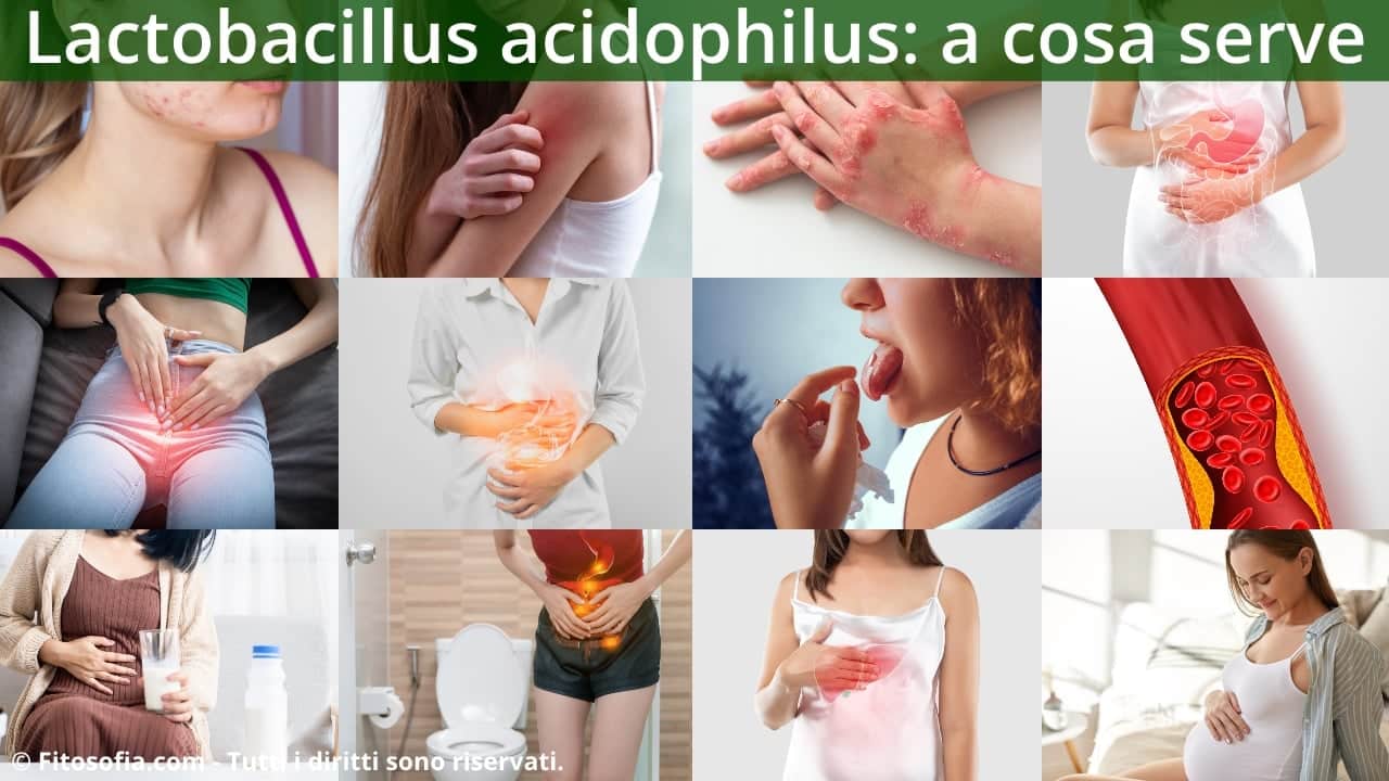 Lactobacillus acidophilus a cosa serve